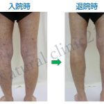 脚裏側＃79