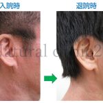 右耳＃92
